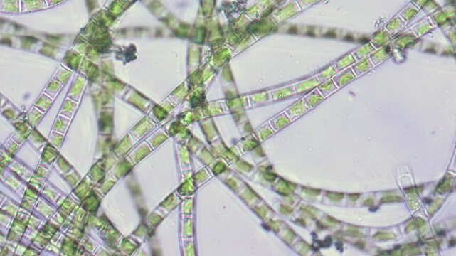 Many threads of algae under microscope magnification.
