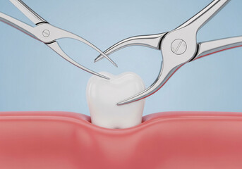The Process of Tooth Extraction with Dental Forceps, a 3D Health Concept