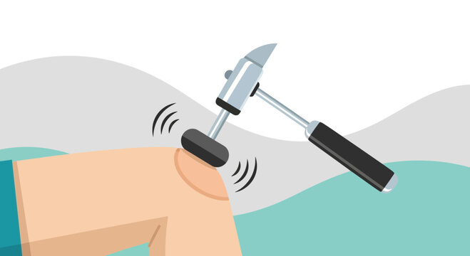 Examining Patellar Reflex Using Reflex Hammer Tool For Medical Illustration