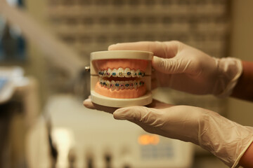 Dentist with Orthodontic tooth model and bracket or brace. Clean and Scrape off tartar. May Orthodontic Health Day, March Oral health, Dentist Day, False Teeth. Toothache and Children Dental Health