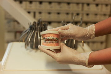 Dentist with Orthodontic tooth model and bracket or brace. Clean and Scrape off tartar. May Orthodontic Health Day, March Oral health, Dentist Day, False Teeth. Toothache and Children Dental Health