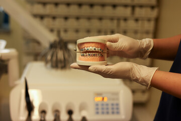 Dentist with Orthodontic tooth model and bracket or brace. Clean and Scrape off tartar. May Orthodontic Health Day, March Oral health, Dentist Day, False Teeth. Toothache and Children Dental Health