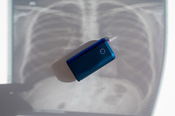 Electronic cigarette and lung x-ray. Tobacco heating system. 