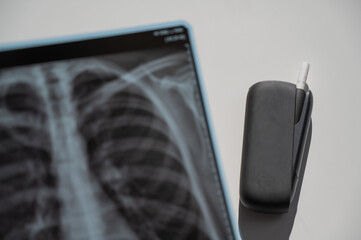 Electronic cigarette and lung x-ray. Tobacco heating system. 