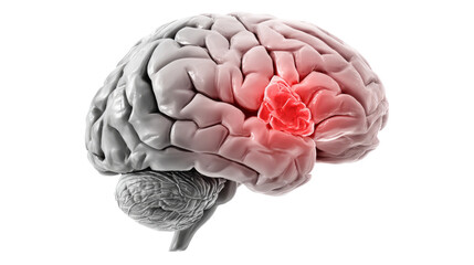 Human brain model displays a lesion area in red isolated on transparent background.
