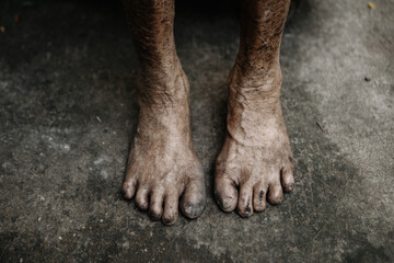 Closeup of weathered bare feet on concrete, showcasing dirt, wrinkles, and skin texture. A raw...