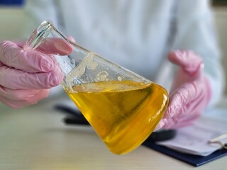 Laboratory experiment with yellow liquid in a glass flask held by a scientist wearing gloves concept selected focus