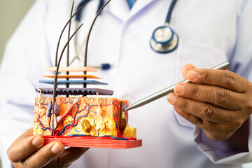 Asian dermatologist doctor holding skin structure model anatomy for treatment in hospital, hair...