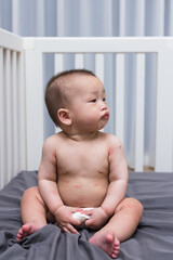 Small infant with red rash on body
