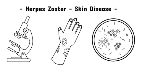 Exposure design of herpes zoster skin disease on the hand and illustration of microscope and virus. In outline style.