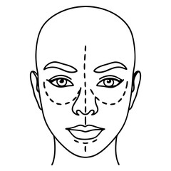 Face with surgical markings indicating cosmetic procedure areas. Face with surgical markings for aesthetic surgery shows areas for potential interventions.