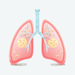 Human Lungs Anatomy: An artistic illustration of healthy lungs, showcasing their structure in vibrant detail, is a vivid representation of the respiratory system.