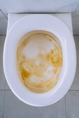 Top-down view of stained toilet bowl with clear water under soft daylight Generative AI