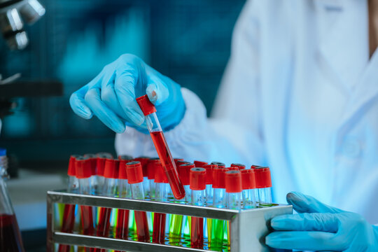 A scientist in a laboratory conducts a medical experiment with a red liquid in a test tube, focusing on analysis, discovery, innovation, and scientific precision.