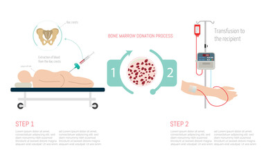 Bone marrow donation process showing extraction and transfusion