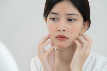 Woman worried about face Dermatology, rosacea dermatitis, allergic steroids, sensitive skin, red...