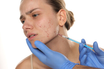 Studio shot of young woman receiving acne treatment injection, concerned facial expression, white...