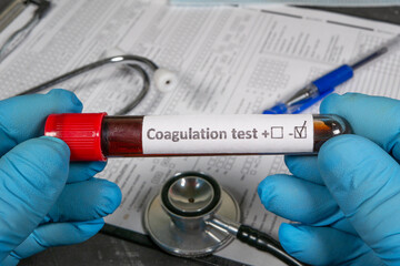 Doctor holding blood sample for coagulation test with positive result