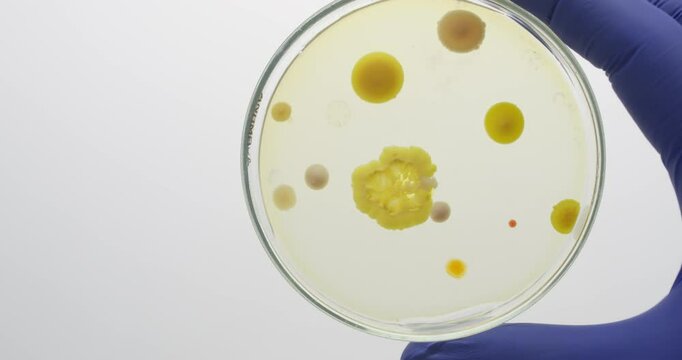 Petri dish with yellow colonies of staphylococcus in the background.