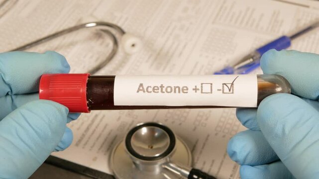 Doctor holding acetone positive blood test tube