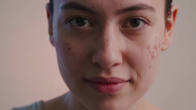  Portrait frontal d&rsquo;une femme au visage marqu&eacute;, sourire subtil