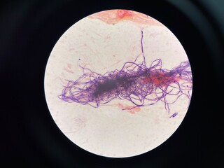 Pseudo-hyphae are chains of elongated yeast cells that remain attached after budding and resemble...