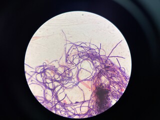 Pseudo-hyphae are chains of elongated yeast cells that remain attached after budding and resemble...