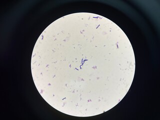 A microorganism, also known as a microbe, is a tiny living organism that is usually too small to be...