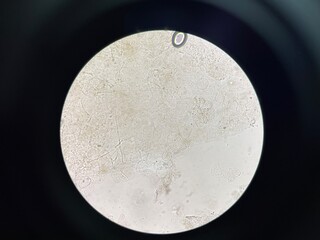A microorganism, also known as a microbe, is a tiny living organism that is usually too small to be...