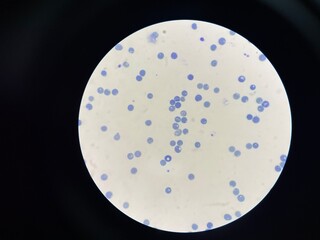 A reticulocyte is an immature red blood cell (RBC) that has recently been released from the bone marrow into the bloodstream. 