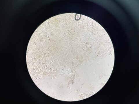 A microorganism, also known as a microbe, is a tiny living organism that is usually too small to be seen with the naked eye and requires a microscope to observe