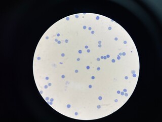 A reticulocyte is an immature red blood cell (RBC) that has recently been released from the bone...