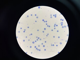 A reticulocyte is an immature red blood cell (RBC) that has recently been released from the bone...