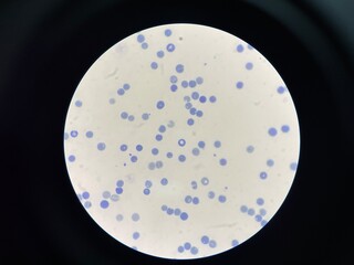 A reticulocyte is an immature red blood cell (RBC) that has recently been released from the bone marrow into the bloodstream. 