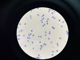 A reticulocyte is an immature red blood cell (RBC) that has recently been released from the bone...