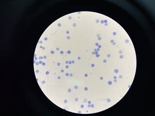 A reticulocyte is an immature red blood cell (RBC) that has recently been released from the bone...