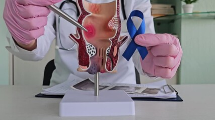 A doctor holds a model of the colon and a blue ribbon, explaining colon cancer awareness
