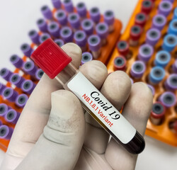 Blood sample for SARS CoV-2 Omicron subvariant LF.7, XFG, JN-1, NB 1.8.1 'Centaurus' virus mutation test at medical laboratory.