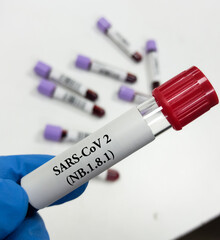 Blood sample for SARS CoV-2 Omicron subvariant LF.7, XFG, JN-1, NB 1.8.1 'Centaurus' virus mutation test at medical laboratory.