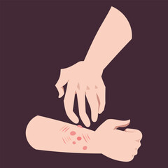 Human arm scratching itchy skin because of bug bites. Hives or bumps on hand arm. Simple flat colorful drawings isolated on square dark background.