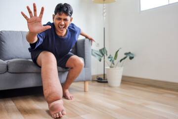 Portrait Of Young Asian Guy Sitting On Sofa With One Leg Heavily Swollen Showing Stop Gesture