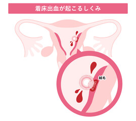 着床出血が起こるしくみ