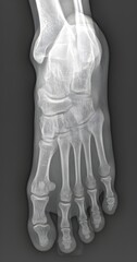 image results from an X-ray examination of the sole of the foot