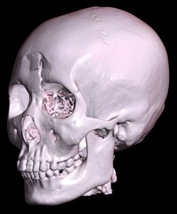 3D reconstruction image results of the head from a radiological CT scan examination