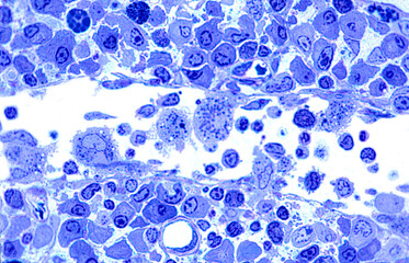 Lymph node. Medullary sinus. Macrophages