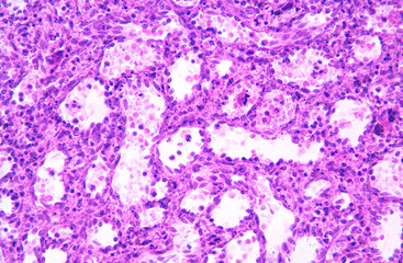 Human spleen. Red pulp