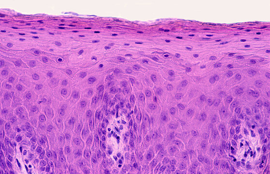Non-keratinized stratified squamous epithelium