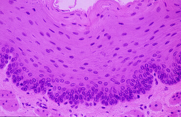 Non-keratinized stratified squamous epithelium