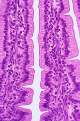 Intestinal epithelium