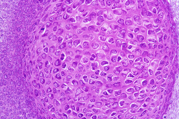 Chondrogenesis. Interstitial growth